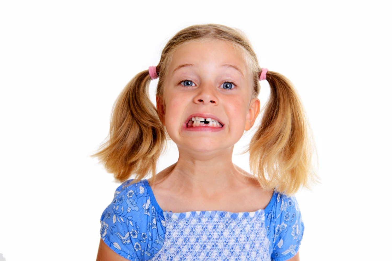 Little girl missing teeth