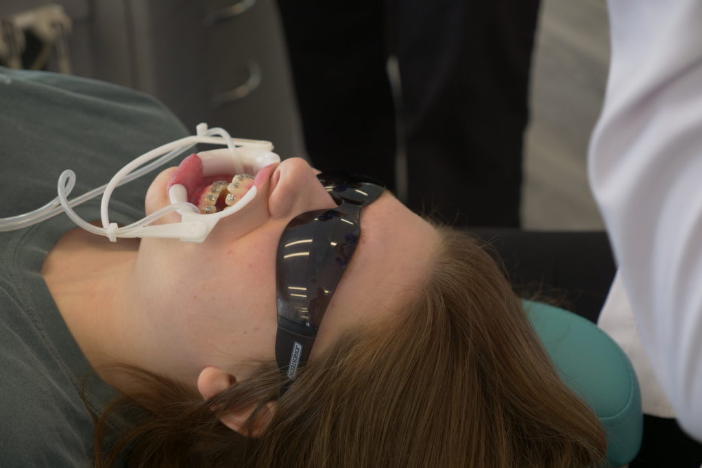 Swan Orthodontics patient getting braces