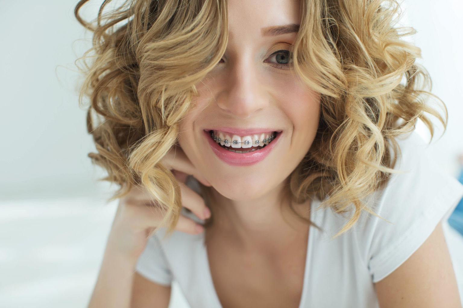 The Benefits of Braces and How They Can Help - Swan Orthodontics