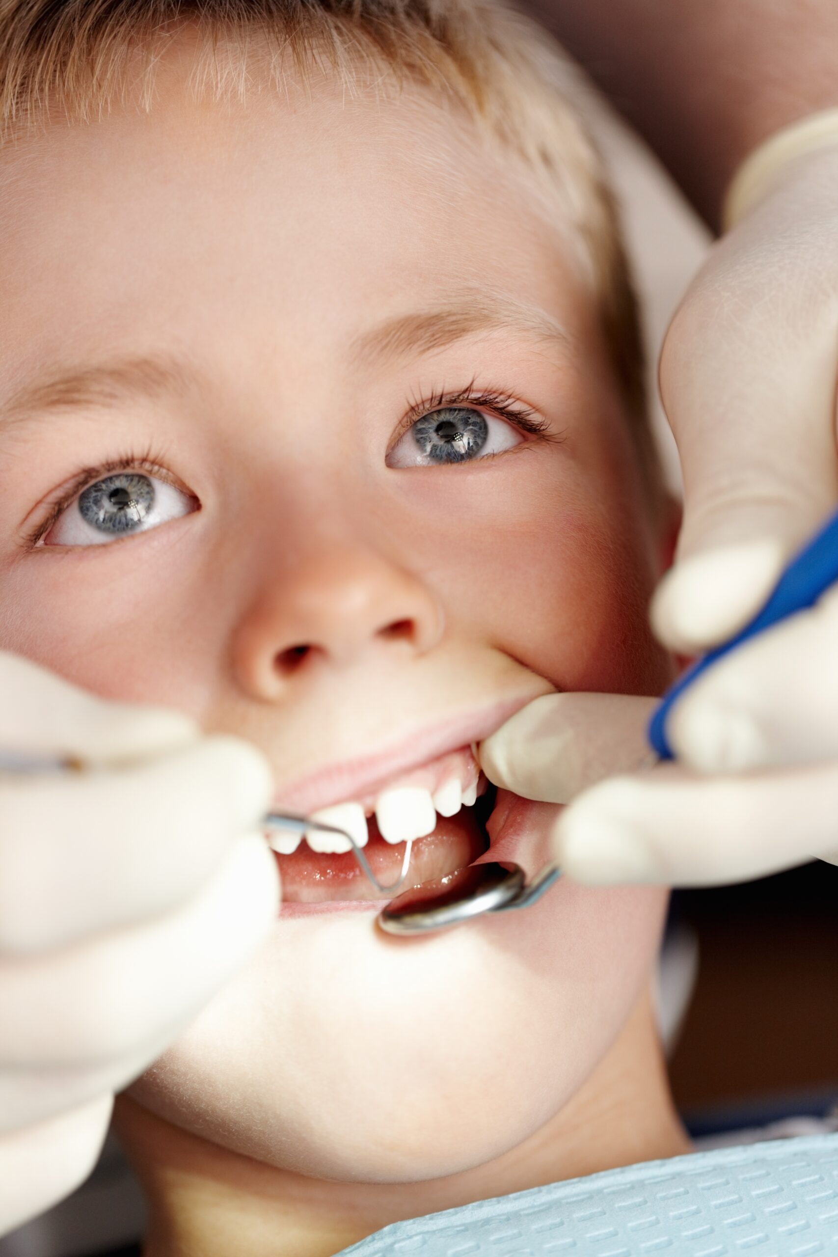 Hands,,Dentist,And,Boy,With,Mirror,Of,Consultation,,Teeth,Whitening Hands,,Dentist,And,Boy,With,Mirror,Of,Consultation,,Teeth,Whitening